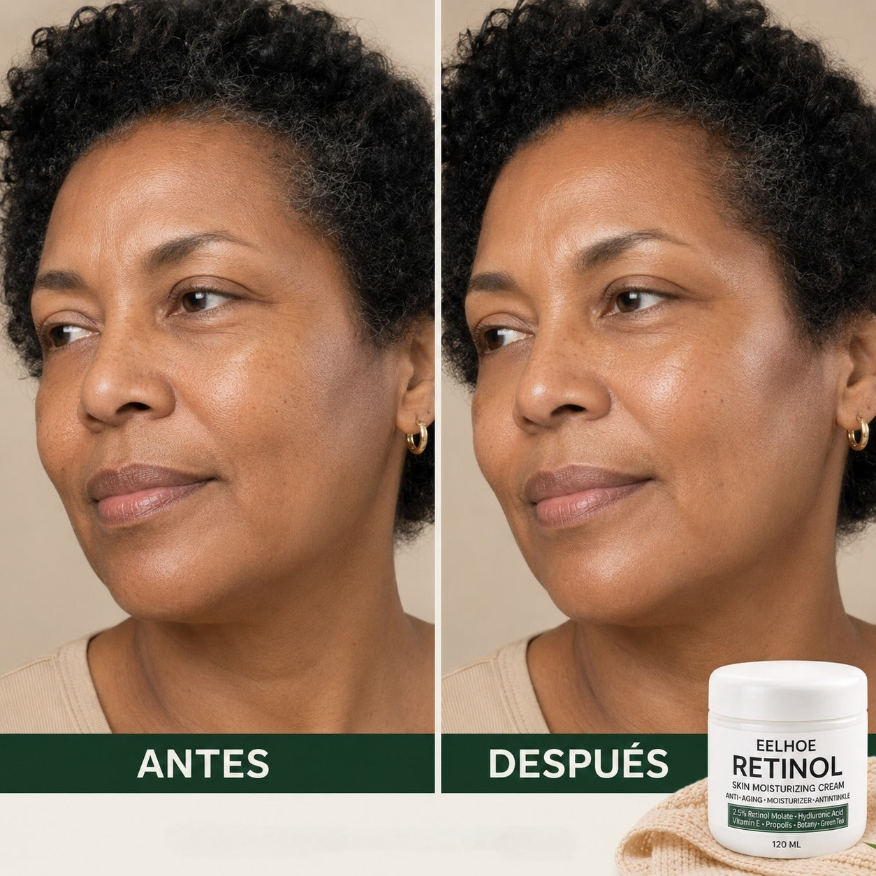 Crema Hidratante con Retinol EELHOE –250